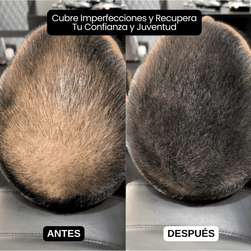 Sculpix™️ | Dile Adiós a las entradas, canas y calvicie
